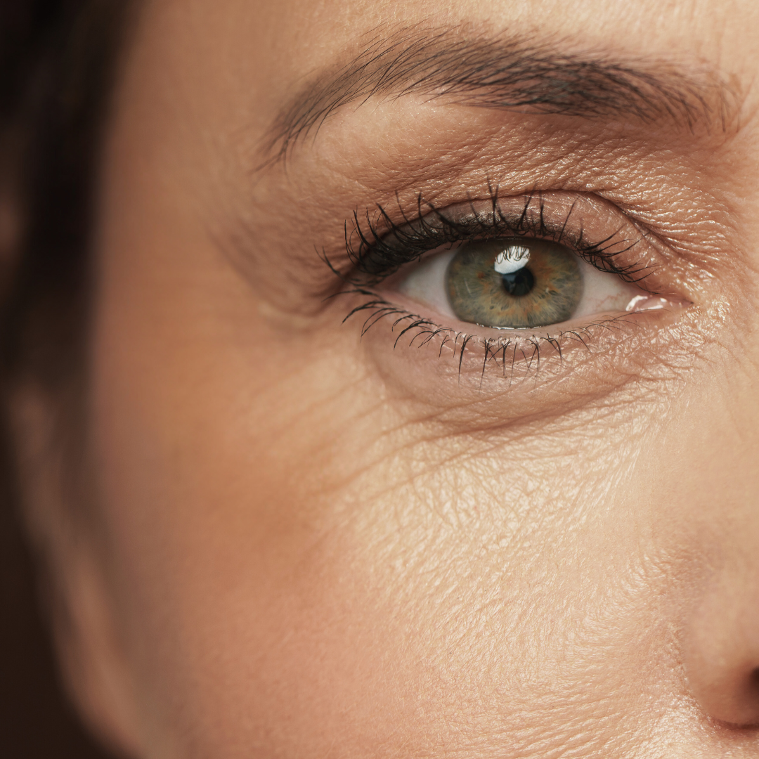 How to fix hyper-pigmentation and dark spots with natural ingredients