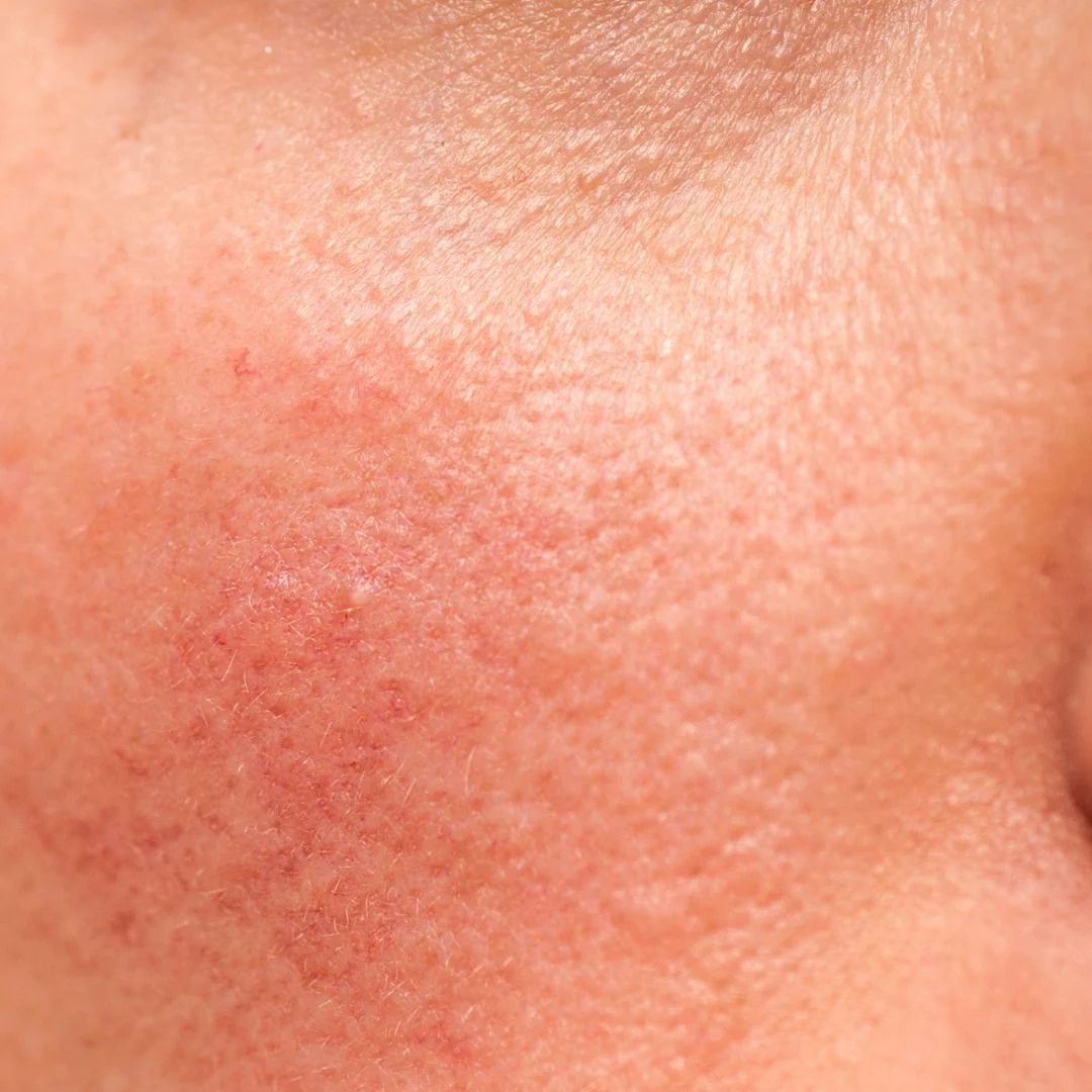 The Ultimate Cleansing Routine for Sensitive Skin